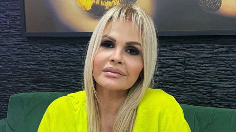 Monique Evans divulga antes e depois de harmonização facial